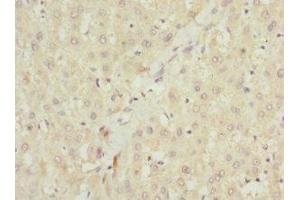 Immunohistochemistry of paraffin-embedded human liver tissue using ABIN7151087 at dilution of 1:100 (NHLRC1 antibody  (AA 1-280))