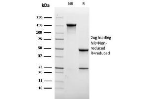 SDS-PAGE Analysis Purified CD31 Recombinant Mouse Monoclonal Antibody (rC31. (Recombinant CD31 antibody)