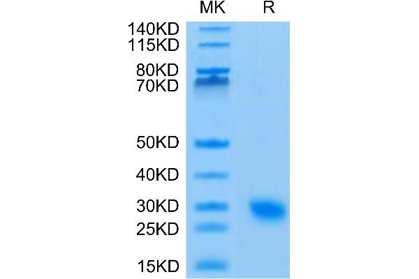 IL17F Protein (AA 31-163) (His tag)