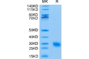 IL17F Protein (AA 31-163) (His tag)