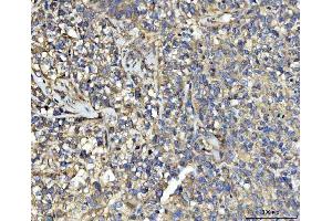 IHC analysis of UBA5 using anti-UBA5 antibody (ABIN7601503).