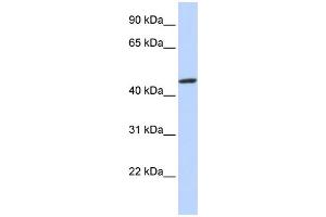 WB Suggested Anti-ZNF239 Antibody Titration:  0. (ZNF239 antibody  (N-Term))