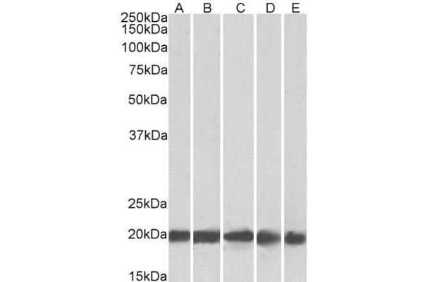 FTL antibody  (C-Term)