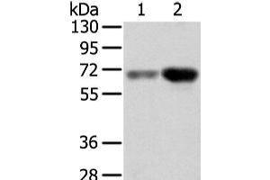 Western Blot analysis of Human lung cancer and placenta tissue using TBL1X Polyclonal Antibody at dilution of 1/500 (TBL1X antibody)