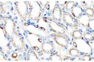 Immunohistochemistry of paraffin-embedded Mouse kidney using RNF149 Polyclonal Antibody at dilution of 1:100 (40x lens). (RNF149 antibody)