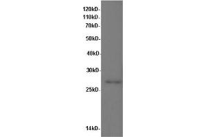 Western Blot analysis of Rat kidney tissue using IL10 Polyclonal Antibody at dilution of 1:600 (IL-10 antibody)