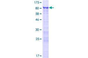 GNL3L Protein (AA 1-582) (GST tag)