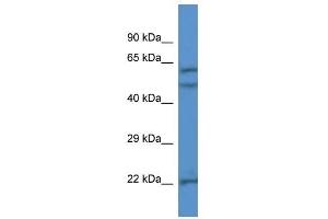 Western Blot showing HPSE antibody used at a concentration of 1 ug/ml against Jurkat Cell Lysate (HPSE antibody  (N-Term))