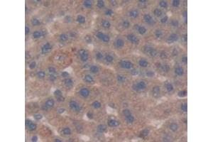 IHC-P analysis of Rat Tissue, with DAB staining. (Glucose-6-Phosphate Dehydrogenase antibody  (AA 1-515))