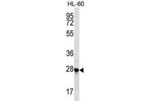 CL052 Antibody (N-term) western blot analysis in HL-60 cell line lysates (35µg/lane). (Chromosome 12 Open Reading Frame 52 (C12orf52) (AA 43-72), (N-Term) antibody)