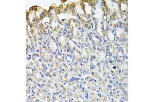 Immunohistochemistry of paraffin-embedded mouse stomach using TUBB8 antibody.
