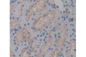 Figure. (GGT5 antibody  (AA 388-586))