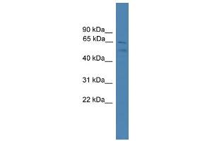 WB Suggested Anti-SPATA2 Antibody Titration: 0. (SPATA2 antibody  (C-Term))