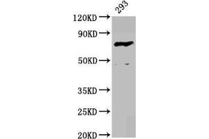 Western Blot Positive WB detected in: 293 whole cell lysate All lanes: F13B antibody at 4. (F13B antibody  (AA 260-403))