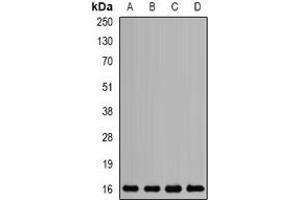 Western blot analysis of Mms2 expression in SKOV3 (A), HL60 (B), mouse liver (C), rat brain (D) whole cell lysates.