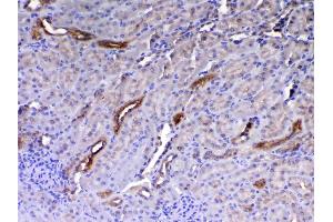 Immunohistochemistry (IHC) image for anti-WAP Four-Disulfide Core Domain 2 (WFDC2) (AA 31-168) antibody (ABIN5519074)