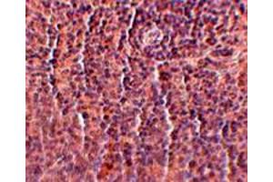 Immunohistochemical staining of rat spleen tissue with 2. (ORAI3 antibody  (C-Term))