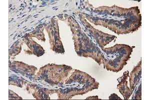 Immunohistochemistry (IHC) image for anti-Aldehyde Dehydrogenase 1 Family, Member A3 (ALDH1A3) (AA 1-100), (AA 413-512) antibody (ABIN2715887) (ALDH1A3 antibody  (AA 1-100, AA 413-512))