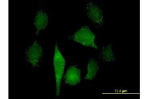 Immunofluorescence of purified MaxPab antibody to GNPAT on HeLa cell. (GNPAT antibody  (AA 1-680))