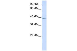 KLHDC2 antibody used at 1 ug/ml to detect target protein. (KLHDC2 antibody  (N-Term))