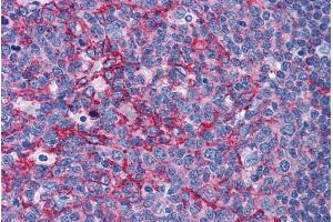 ABIN184755 (3. (Flotillin 2 antibody  (C-Term))