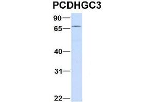 Host:  Rabbit  Target Name:  CHAD  Sample Type:  Human Adult Placenta  Antibody Dilution:  1. (Protocadherin gamma Subfamily C, 3 (PCDHGC3) (C-Term) antibody)