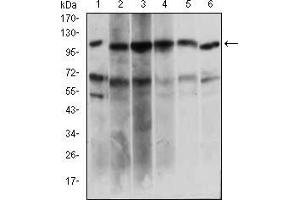 Western blot analysis using PAPLN mouse mAb against Hela (1), HepG2 (2), OCM-1 (3), Raji (4), Jurkat (5), NIH/3T3 (6) cell lysate. (PAPLN antibody  (AA 766-870))
