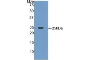 Detection of Recombinant CORO1A, Human using Polyclonal Antibody to Coronin 1A (CORO1A) (Coronin 1a antibody  (AA 7-204))