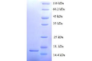 SDS-PAGE (SDS) image for Serum Amyloid A2 (SAA2) (AA 20-122) protein (His tag) (ABIN4974919)