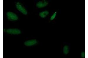 Immunofluorescent staining of HeLa cells using anti-AP2M1 mouse monoclonal antibody (ABIN2454660). (AP2M1 antibody  (AA 97-383))
