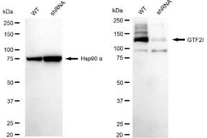 Western blotting analysis using GTF2I antibody (ABIN7798709).