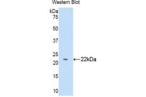 Detection of Recombinant a1BG, Human using Polyclonal Antibody to Alpha-1-B-Glycoprotein (a1BG) (A1BG antibody  (AA 22-206))
