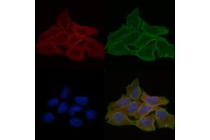 ABIN6258861 and ABIN6274219 staining Hela cells(30 min of UV treatment) by IF/ICC. (ITPKB antibody  (Internal Region))