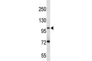 PSMA antibody western blot analysis in ZR-75-1 lysate.