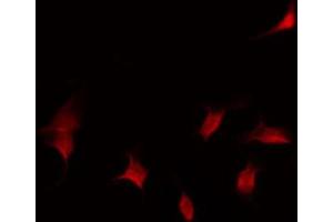 ABIN6267587 staining Hela by IF/ICC. (RUNX1 antibody  (pSer276))