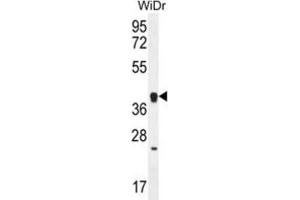 Western Blotting (WB) image for anti-Olfactory Receptor, Family 2, Subfamily T, Member 8 (OR2T8) antibody (ABIN2996544) (OR2T8 antibody)