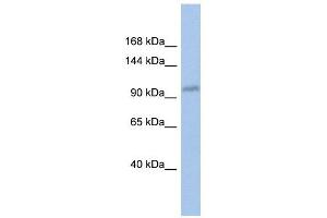 DDX24 antibody used at 1 ug/ml to detect target protein. (DDX24 antibody)