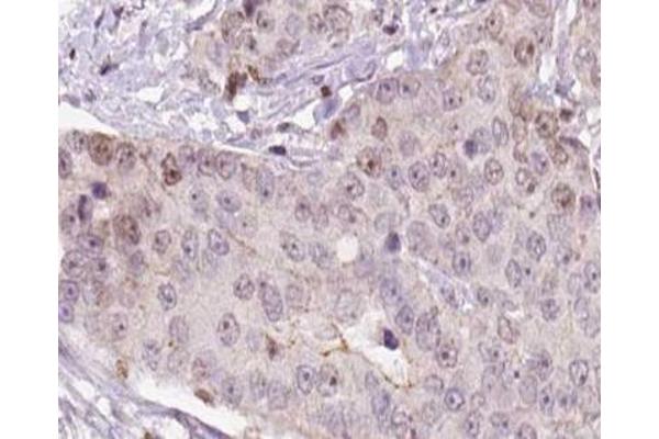 HCG beta antibody