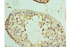 Immunohistochemistry of paraffin-embedded human testis tissue using ABIN7174360 at dilution of 1:100 (USP8 antibody  (C-Term))