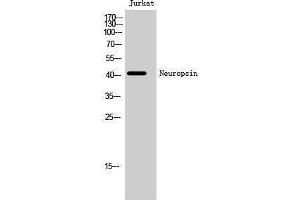 Western Blotting (WB) image for anti-Opsin 5 (OPN5) (C-Term) antibody (ABIN3185858) (OPN5 antibody  (C-Term))
