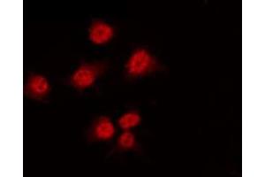 ABIN6267506 staining HT29 by IF/ICC. (HNF4A antibody  (pSer313))