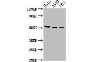 Western Blot Positive WB detected in: Hela whole cell lysate, A549 whole cell lysate, PC-3 whole cell lysate All lanes: ALS2CR12 antibody at 12 μg/mL Secondary Goat polyclonal to rabbit IgG at 1/50000 dilution Predicted band size: 53, 50 kDa Observed band size: 53 kDa (ALS2CR12 antibody  (AA 26-76))