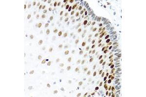 Immunohistochemistry of paraffin-embedded human esophagus using KHDRBS2 antibody (ABIN5975782) at dilution of 1/100 (40x lens).
