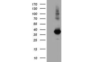 Western Blotting (WB) image for anti-Monoglyceride Lipase (MGLL) antibody (ABIN1499443) (MGLL antibody)