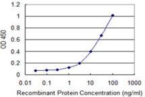 Detection limit for recombinant GST tagged SFMBT1 is 0. (SFMBT1 antibody  (AA 121-230))