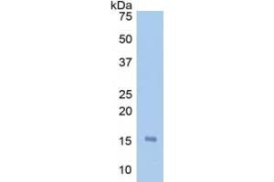 Western Blotting (WB) image for Haptoglobin (HP) ELISA Kit (ABIN6574107)