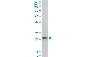 RPS5 monoclonal antibody (M02), clone 4H3. (RPS5 antibody  (AA 106-204))