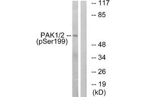 Western blot analysis of extracts from LOVO cells treated with starved using PAK1/2 (Phospho-Ser199) Antibody. (PAK1 antibody  (pSer199))