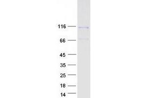 Validation with Western Blot (DAAM1 Protein (Myc-DYKDDDDK Tag))
