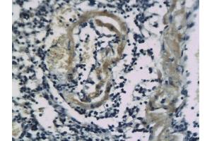 Formalin-fixed and paraffin embedded mouse lung tissue labeled with Anti-SSTR2 Polyclonal Antibody, Unconjugated (ABIN738216) followed by conjugation to the secondary antibody and DAB staining (SSTR2 antibody  (AA 211-320))